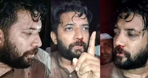 പൊലീസ് മര്‍ദ്ദനത്തില്‍ ഗുരുതരമായി പരിക്കേറ്റ ഷാഫി പറമ്പില്‍ എംപിയ്‌ക്കെതിരെ കേസ് ; പൊലീസിനെ ആക്രമിച്ചതിനും കൊലപാതക ശ്രമത്തിനും കേസെടുത്തു